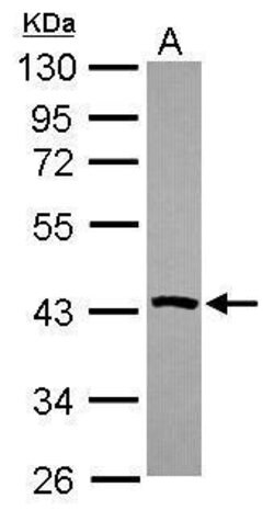 Invitrogen PSAT1 Polyclonal Antibody 100 μL; Unconjugated:Antibodies,