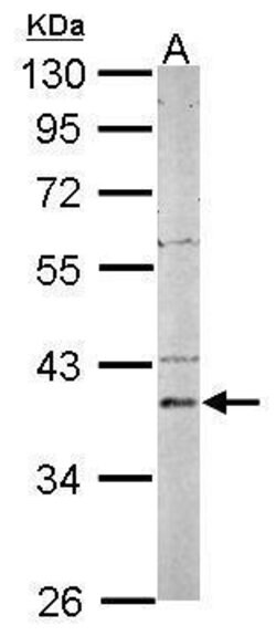 Invitrogen PSAT1 Polyclonal Antibody 100 μL; Unconjugated:Antibodies,