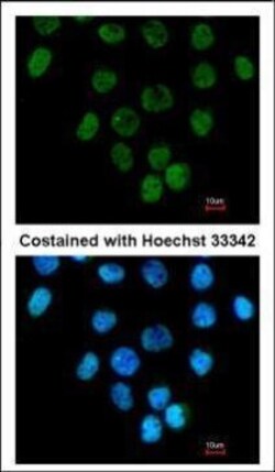 Invitrogen CARP Polyclonal Antibody 100 &mu;L | Buy Online | Invitrogen&trade; | Fisher Scientific