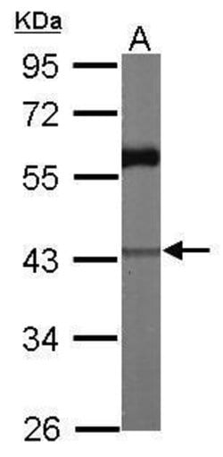 Invitrogen CARP Polyclonal Antibody 100 &mu;L; Unconjugated:Antibodies,