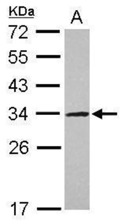 Invitrogen UTP11L Polyclonal Antibody 100 &mu;L; Unconjugated:Antibodies,