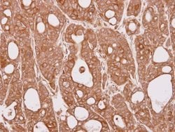 Invitrogen CEP57 Polyclonal Antibody 100 &mu;L; Unconjugated:Antibodies,