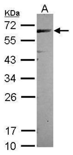 Invitrogen CEP57 Polyclonal Antibody 100 &mu;L; Unconjugated:Antibodies,