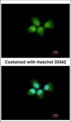 Invitrogen PHAP I Polyclonal Antibody 100 &mu;L; Unconjugated:Antibodies,