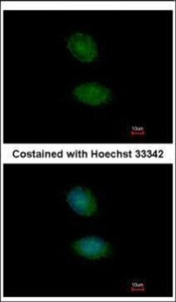Invitrogen AMMECR1 Polyclonal Antibody 100 &mu;L; Unconjugated:Antibodies,