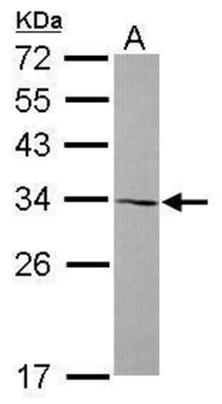 Invitrogen AMMECR1 Polyclonal Antibody 100 &mu;L; Unconjugated:Antibodies,