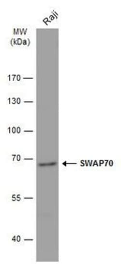 Invitrogen SWAP70 Polyclonal Antibody 100 &mu;L | Buy Online | Invitrogen&trade; | Fisher Scientific