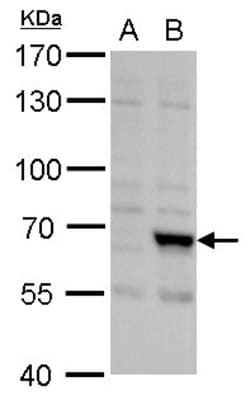 Invitrogen FBXL4 Polyclonal Antibody 100 &mu;L; Unconjugated:Antibodies,