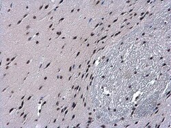 Invitrogen HIST1H2BD Polyclonal Antibody 100 &mu;L | Buy Online | Invitrogen&trade; | Fisher Scientific