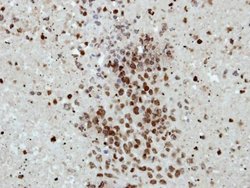 Invitrogen HIST1H2BD Polyclonal Antibody 100 &mu;L | Buy Online | Invitrogen&trade; | Fisher Scientific