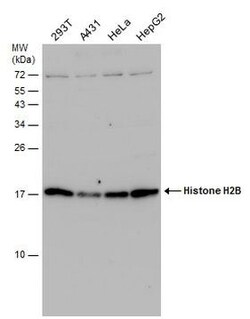 Invitrogen HIST1H2BD Polyclonal Antibody 100 &mu;L | Buy Online | Invitrogen&trade; | Fisher Scientific