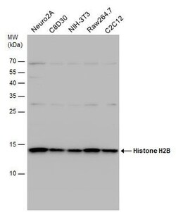 Invitrogen HIST1H2BD Polyclonal Antibody 100 &mu;L | Buy Online | Invitrogen&trade; | Fisher Scientific