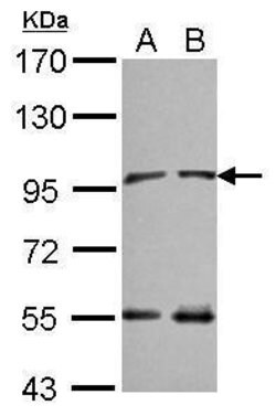 Invitrogen NAA15 Polyclonal Antibody 100 &mu;L; Unconjugated:Antibodies,