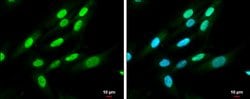 Invitrogen QKI Polyclonal Antibody 100 &mu;L; Unconjugated:Antibodies,