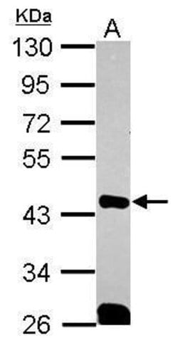 Invitrogen QKI Polyclonal Antibody 100 &mu;L; Unconjugated:Antibodies,