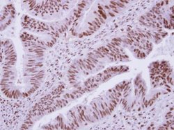 Invitrogen DCPS Polyclonal Antibody 100 &mu;L; Unconjugated:Antibodies,
