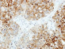 Invitrogen B4GALT4 Polyclonal Antibody 100 &mu;L; Unconjugated:Antibodies,