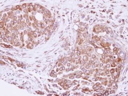 Invitrogen ATE1 Polyclonal Antibody 100 &mu;L; Unconjugated:Antibodies,