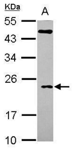 Invitrogen TC10 Polyclonal Antibody 100 &mu;L; Unconjugated:Antibodies,