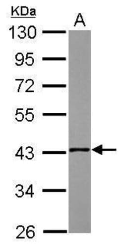 Invitrogen NSDHL Polyclonal Antibody 100 &mu;L; Unconjugated:Antibodies,