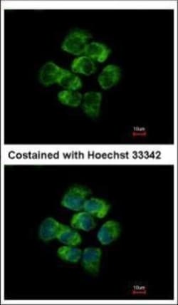 Invitrogen Protein APC Polyclonal Antibody 100 &mu;L; Unconjugated:Antibodies,