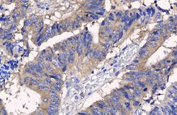 Invitrogen Protein APC Polyclonal Antibody 100 &mu;L; Unconjugated:Antibodies,