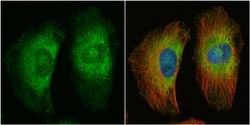Invitrogen Protein APC Polyclonal Antibody 100 &mu;L; Unconjugated:Antibodies,