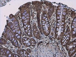 Invitrogen Protein APC Polyclonal Antibody 100 &mu;L; Unconjugated:Antibodies,