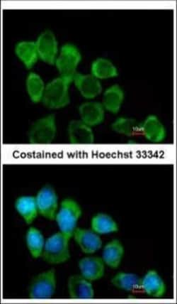 Invitrogen Involucrin Polyclonal Antibody 100 &mu;L | Buy Online | Invitrogen&trade; | Fisher Scientific