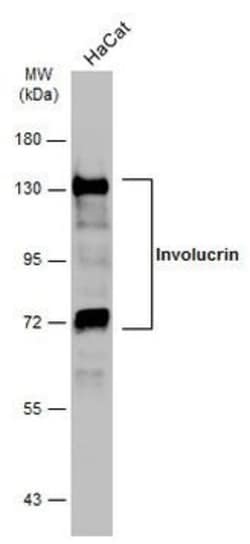 Invitrogen Involucrin Polyclonal Antibody 100 &mu;L | Buy Online | Invitrogen&trade; | Fisher Scientific