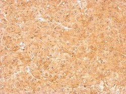 Invitrogen LOR Polyclonal Antibody 100 &mu;L; Unconjugated:Antibodies,