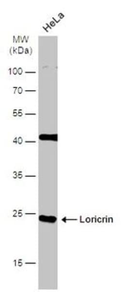 Invitrogen LOR Polyclonal Antibody 100 &mu;L; Unconjugated:Antibodies,