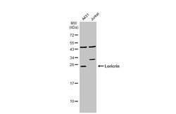 Invitrogen LOR Polyclonal Antibody 100 &mu;L; Unconjugated:Antibodies,