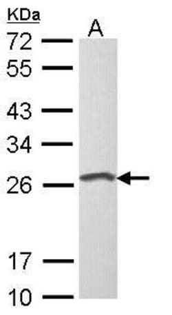 Invitrogen LOR Polyclonal Antibody 100 &mu;L; Unconjugated:Antibodies,