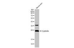 Invitrogen LOR Polyclonal Antibody 100 &mu;L; Unconjugated:Antibodies,