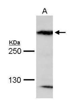 Invitrogen MAP1B Polyclonal Antibody 100 &mu;L; Unconjugated:Antibodies,