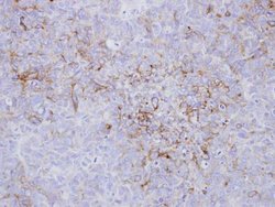 Endothelin A Receptor Polyclonal Antibody, Invitrogen 100 &mu;L; Unconjugated:Antibodies,