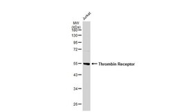 PAR1 Polyclonal Antibody, Invitrogen 100 &mu;L; Unconjugated:Antibodies,