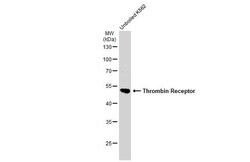 PAR1 Polyclonal Antibody, Invitrogen 100 &mu;L; Unconjugated:Antibodies,