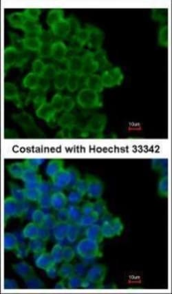 Invitrogen FABP4 Polyclonal Antibody 100 &mu;L; Unconjugated:Antibodies,