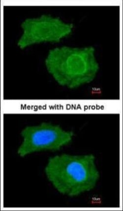 Invitrogen FABP4 Polyclonal Antibody 100 &mu;L; Unconjugated:Antibodies,