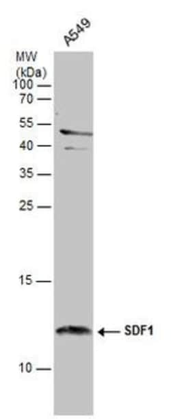 Invitrogen CXCL12 Polyclonal Antibody 100 &mu;L; Unconjugated:Antibodies,