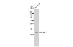 Invitrogen CXCL12 Polyclonal Antibody 100 &mu;L; Unconjugated:Antibodies,