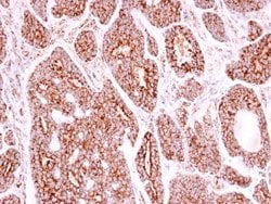 Invitrogen&trade;&nbsp;SOD2 Polyclonal Antibody