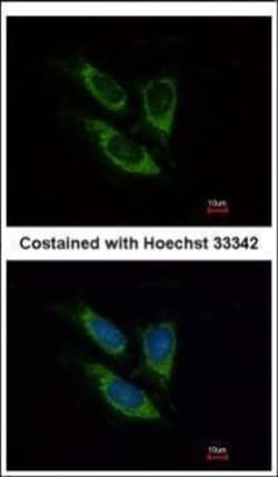 Invitrogen SOD2 Polyclonal Antibody 100 &mu;L | Buy Online | Invitrogen&trade; | Fisher Scientific