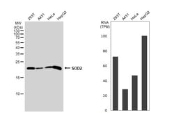 Invitrogen SOD2 Polyclonal Antibody 100 &mu;L | Buy Online | Invitrogen&trade; | Fisher Scientific