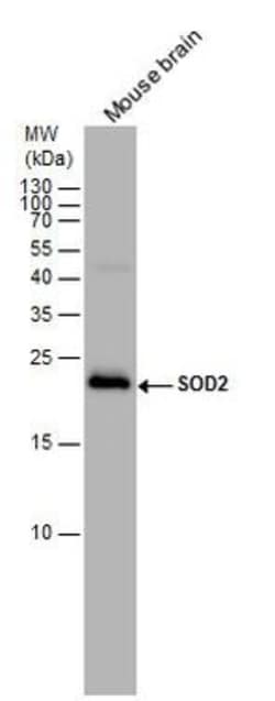 Invitrogen SOD2 Polyclonal Antibody 100 &mu;L | Buy Online | Invitrogen&trade; | Fisher Scientific