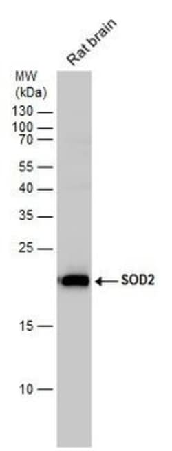 Invitrogen SOD2 Polyclonal Antibody 100 &mu;L | Buy Online | Invitrogen&trade; | Fisher Scientific
