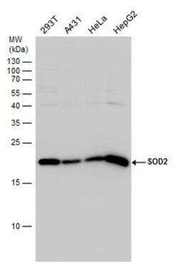 Invitrogen SOD2 Polyclonal Antibody 100 &mu;L | Buy Online | Invitrogen&trade; | Fisher Scientific