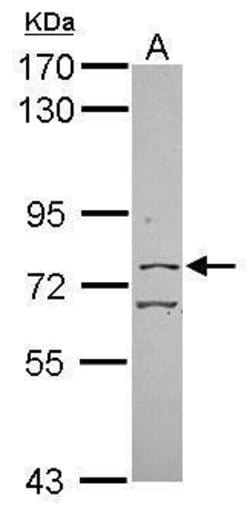 Invitrogen CGBP Polyclonal Antibody 100 &mu;L; Unconjugated:Antibodies